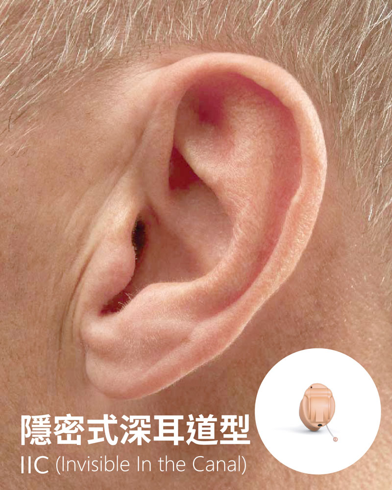 耳掛式 (BTE)